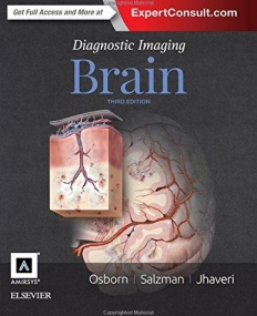 DIAGNOSTIC IMAGING: BRAIN, 3RD EDITION