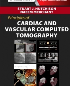 PRINCIPLES OF CARDIAC AND VASCULAR COMPUTED TOMOGRAPHY