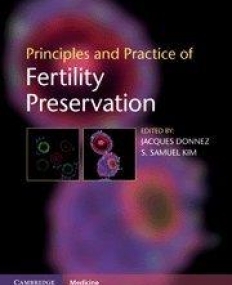 PRINCIPLES AND PRACTICE OF FERTILITY PRESERVATION