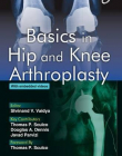 BASICS IN HIP AND KNEE ARTHROPLASTY