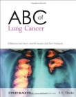 ABC of Lung Cancer