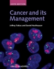Cancer and its Management 6e