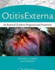 Otitis Externa: An Essential Guide to Diagnosis and Treatment