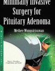 Minimally Invasive Surgery for Pituitary Adenoma