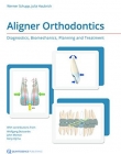 Aligner Orthodontics