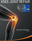 Advanced Quantitative Imaging of Knee Joint Repair