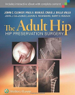 The Adult Hip