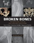 Broken Bones: The Radiologic Atlas of Fractures and Dislocations 