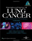 Principles & Practice of Lung Cancer, 4e
