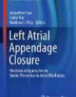 Left Atrial Appendage Closure: Mechanical Approaches to Stroke Prevention in Atrial Fibrillation