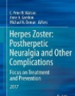 Herpes Zoster: Postherpetic Neuralgia and Other Complications: Focus on Treatment and Prevention