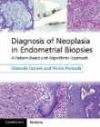 Diagnosis of Neoplasia in Endometrial Biopsies