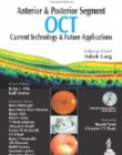 Anterior and Posterior Segment OCT: Current Technology and Future Applications