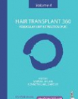 Hair Transplant 360: Volume 4