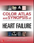 Color Atlas And Synopsis Of Heart Failure