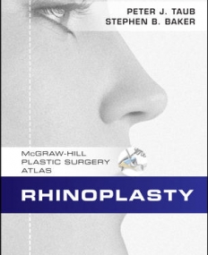 RHINOPLASTY