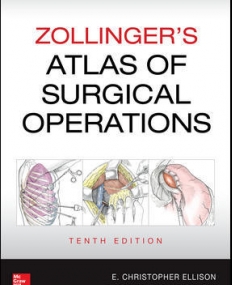 ZOLLINGER'S ATLAS OF SURGICAL OPERATIONS