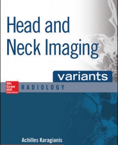 VARIANTS HEAD AND NECK IMAGING