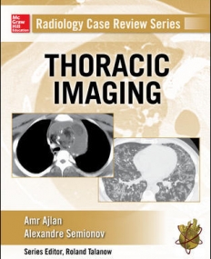 RADIOLOGY CASE REVIEW SERIES: THORACIC IMAGING
