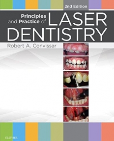 PRINCIPLES AND PRACTICE OF LASER DENTISTRY, 2ND EDITION