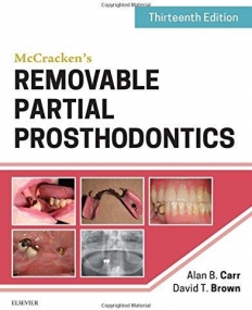McCracken's Removable Partial Prosthodontics , 13th Edition