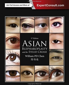 ASIAN BLEPHAROPLASTY AND THE EYELID CREASE, 3RD EDITION