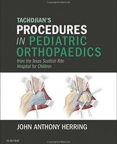 TACHDJIAN'S PROCEDURES IN PEDIATRIC ORTHOPAEDICS, FROM THE TEXAS SCOTTISH RITE HOSPITAL FOR CHILDREN