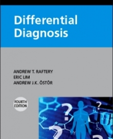 CHURCHILL'S POCKETBOOK OF DIFFERENTIAL DIAGNOSIS IE, 4TH EDITION