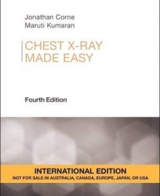 CHEST X-RAY MADE EASY, IE, 4TH EDITION