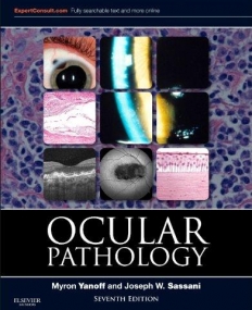 Ocular Pathology, 7th Edition