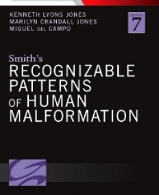 SMITH'S RECOGNIZABLE PATTERNS OF HUMAN MALFORMATION