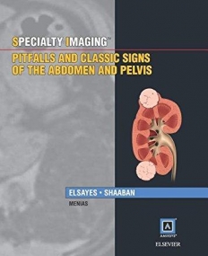 SPECIALTY IMAGING: PITFALLS AND CLASSIC SIGNS OF THE ABDOMEN AND PELVIS