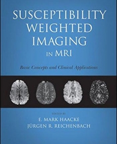 Susceptibility Weighted Imaging in MRI: Basic Concepts and Clinical Applications