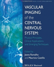 Vascular Imaging of the Central Nervous System: Physical Principles, Clinical Applications, and Emergency Techniques