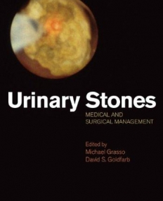 Urinary stones: Medical and Surgical Management