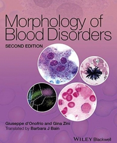 Morphology of Blood Disorders,2e
