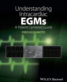 Understanding Intracardiac EGMs: A Patient Centered Guide