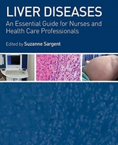 Liver Diseases: An Essential Guide for Nurses and Health Care Professionals