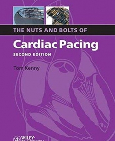 Nuts and Bolts of Cardiac Pacing,2e