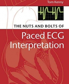 Nuts and bolts of Paced ECG Interpretation