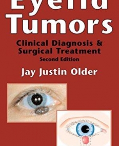 Eyelid Tumours,2e
