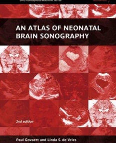 Atlas of Neonatal Brain Sonography,2e