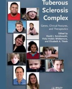 Tuberous Sclerosis Complex: Genes, Clinical Features and Therapeutics