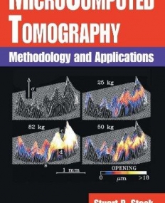 MICROCOMPUTED TOMOGRAPHY METHODOLOGY AND APPLICATIONS