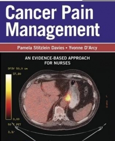 COMPACT CLINICAL GUIDE TO CANCER PAIN MANAGEMENT: AN EVIDENCE-BASED APPROACH FOR NURSES