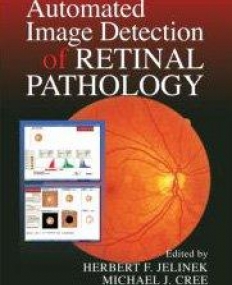 AUTOMATED IMAGE DETECTION OF RETINAL PATHOLOGY