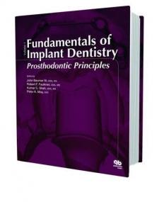 Fundamentals of Implant Dentistry, Vol. 1: Prosthodontic Principles