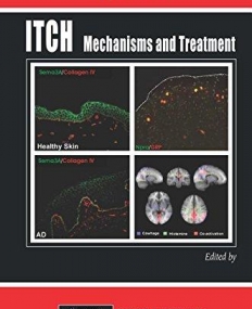 Itch: Mechanisms and Treatment (Frontiers in Neuroscience)