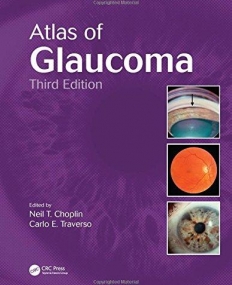 Atlas of Glaucoma, Third Edition