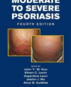 Moderate to Severe Psoriasis, Fourth Edition